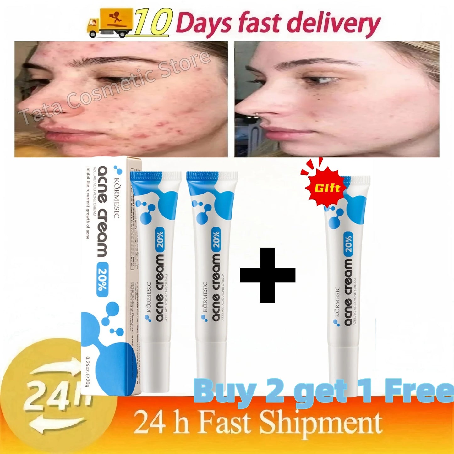 Anti-Acne Gel Acne Treatment Face Cream Repair Pimple