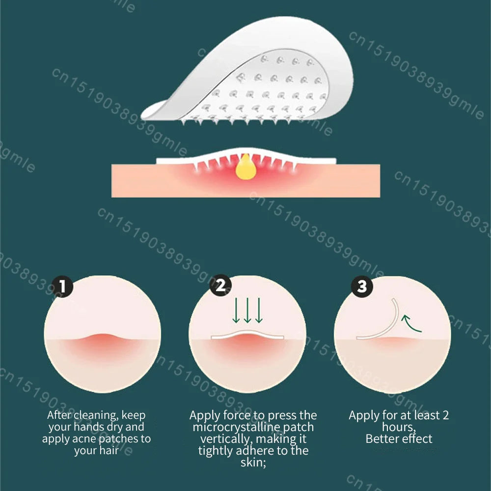 Microneedles Acne Patch Invisible Breathable Skin Care
