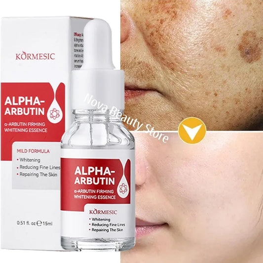 Dark Spots Remover Whitening Serum Face Freckle Melanin