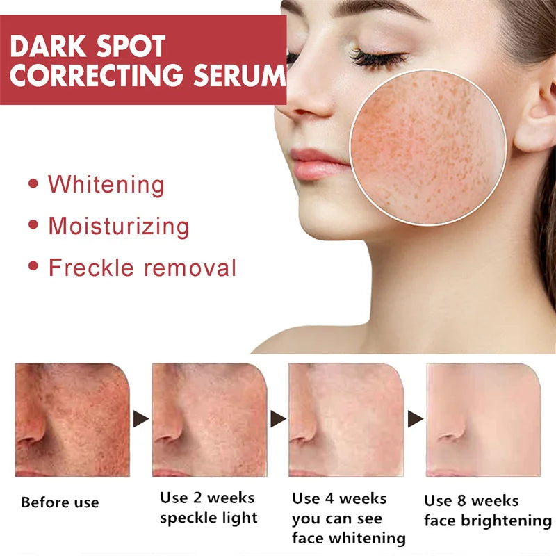 Dark Spots Remover Whitening Serum Face Freckle Melanin