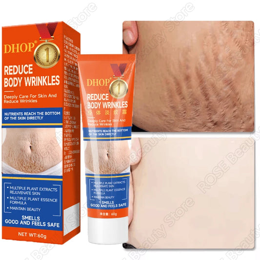 Stretch Marks Permanent Removal Cream Maternity Pregnant