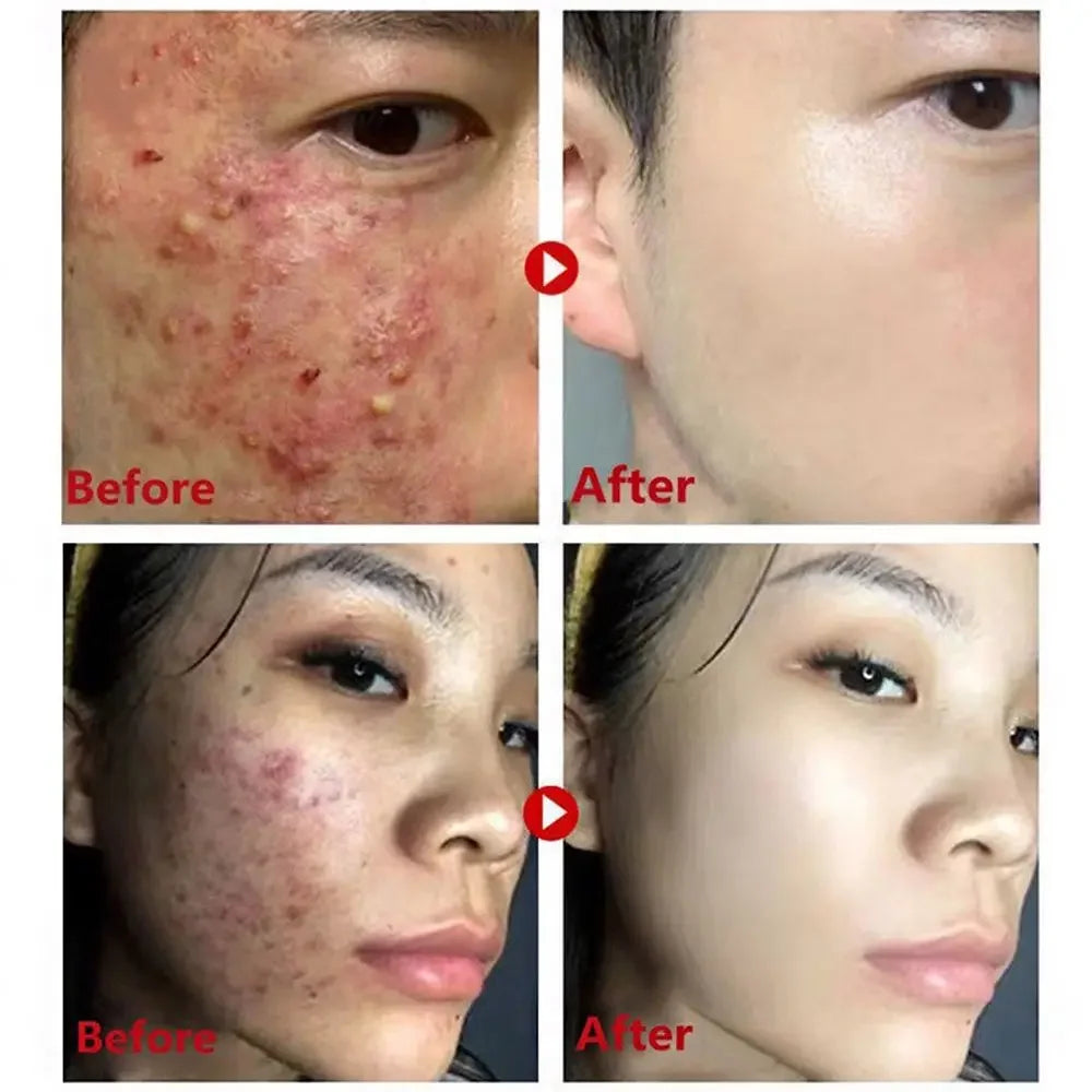 Green Tea Mask Stick Remove Blackheads Acne Deep Cleansing