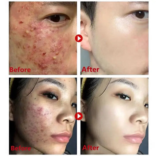 Green Tea Mask Stick Remove Blackheads Acne Deep Cleansing