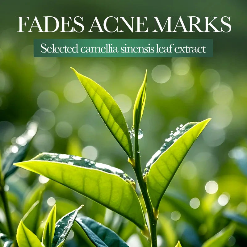 Acne Removal Whitening Serum Effective Fade Acne Spots