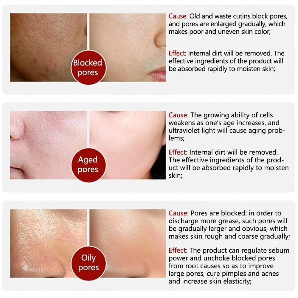 Skin Texture | Pore Refining Resurfacing, Brightening Facial