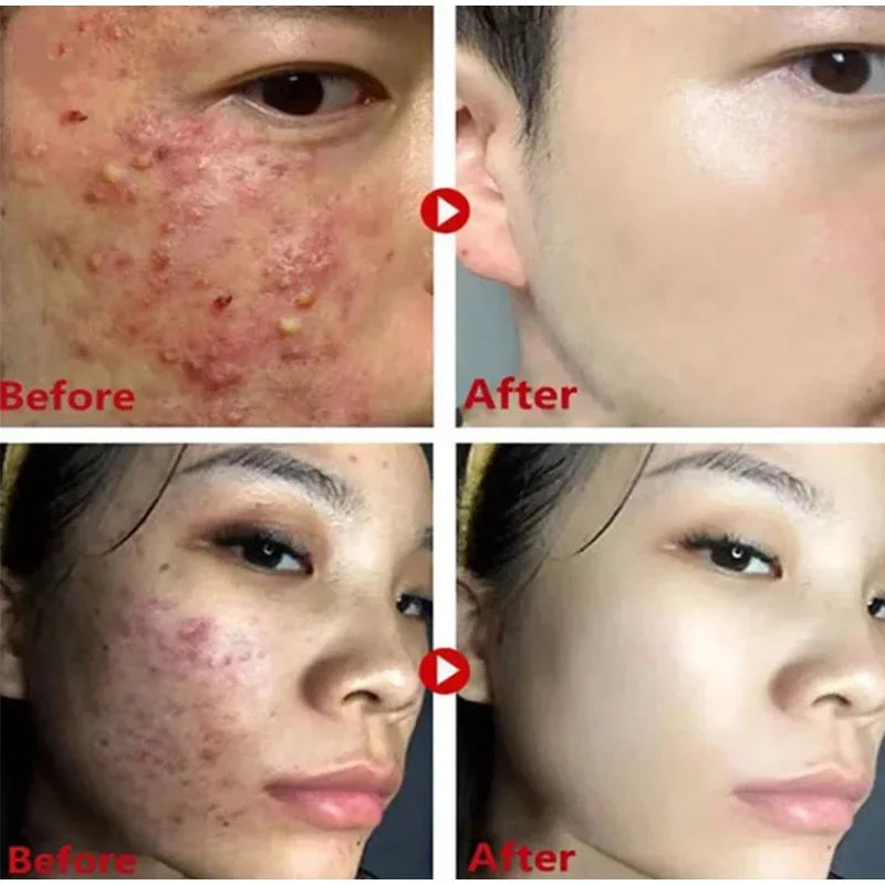 Remove Blackhead Mud Mask Green Tea Face Clean Stick