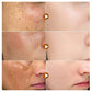 Dark Spots Remover Whitening Serum Face Freckle Melanin