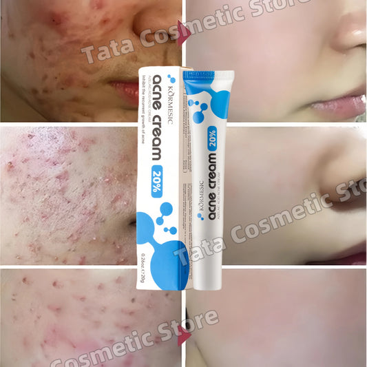 Anti-Acne Gel Acne Treatment Face Cream Repair Pimple