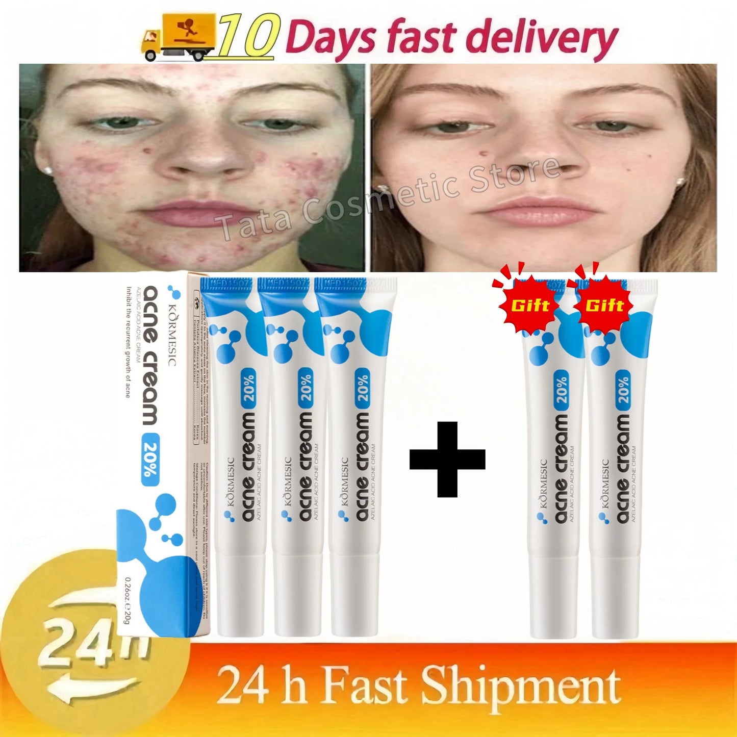 Anti-Acne Gel Acne Treatment Face Cream Repair Pimple