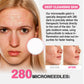 GROEI 18Pcs Microneedle Acne Patches Pimple Invisible Beauty