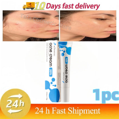 Anti-Acne Gel Acne Treatment Face Cream Repair Pimple