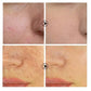 Skin Texture | Pore Refining Resurfacing, Brightening Facial
