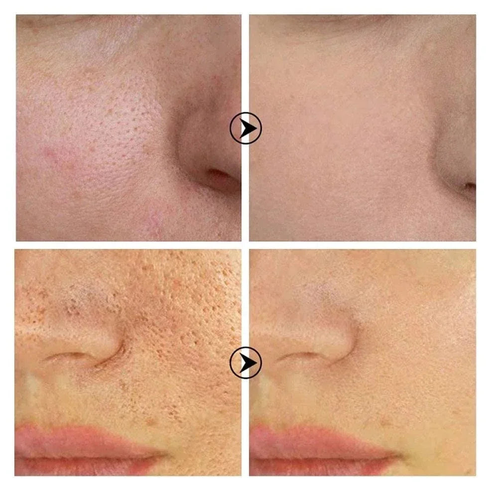 Skin Texture | Pore Refining Resurfacing, Brightening Facial