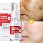 Dark Spots Remover Whitening Serum Face Freckle Melanin