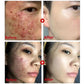 Green Tea Mask Stick Remove Blackheads Acne Deep Cleansing