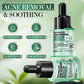 Acne Removal Whitening Serum Effective Fade Acne Spots