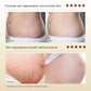 Stretch Marks Permanent Removal Cream Maternity Pregnant