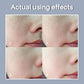 Skin Texture | Pore Refining Resurfacing, Brightening Facial