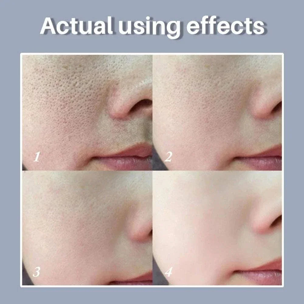 Skin Texture | Pore Refining Resurfacing, Brightening Facial