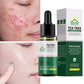 Acne Removal Whitening Serum Effective Fade Acne Spots