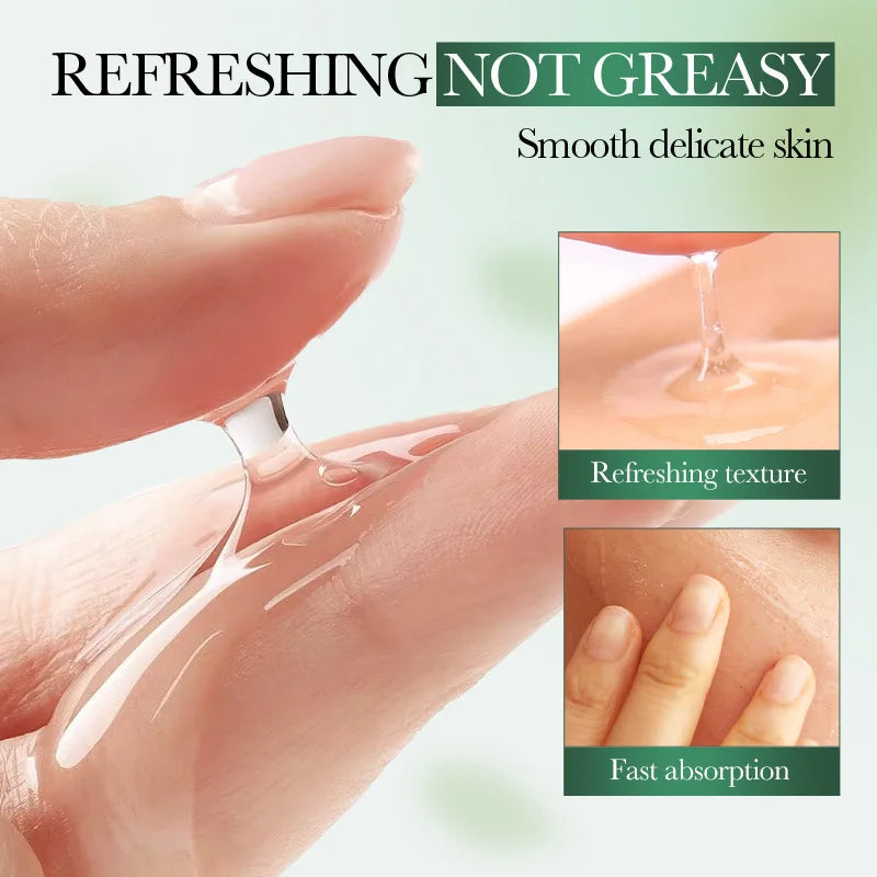 Acne Removal Whitening Serum Effective Fade Acne Spots